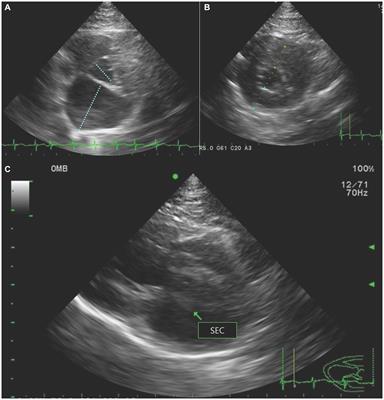 Case report: Evaluation of hindlimb ischemia using 18F-fluorodeoxyglucose positron emission tomography in a cat with cardiogenic arterial thromboembolism